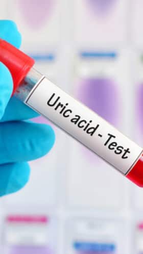 High Uric Acid Management: 10 Home Remedies To Keep The Condition Under Control