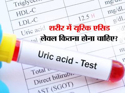 Uric Acid Normal Range In Hindi | Uric Acid Kam Kaise Kare | शरीर में