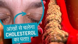 Cholesterol बढ़ने पर आंखों में दिखते हैं ये लक्षण, फौरन कराएं टेस्ट