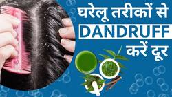 Dandruff Remedies: इस Natural तरीके से रूसी हो जाएगी छूमंतर, देखें वीडियो