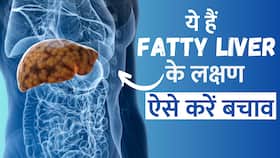 Fatty Liver Symptoms: शरीर में दिखने वाले ये लक्षण करते हैं फैटी लिवर की तरफ इशारा Fatty Liver Symptoms: शरीर में दिखने वाले ये लक्षण करते हैं फैटी लिवर की तरफ इशारा