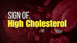 High Cholesterol Can Go Unnoticed: Look Out For These 7 Signs