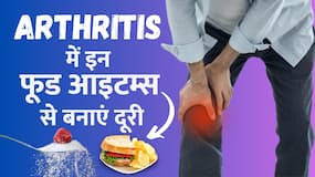 Arthritis के मरीज भूलकर भी खाएं ये Food Items, शरीर को हो सकता है बड़ा नुकसान Arthritis के मरीज भूलकर भी खाएं ये Food Items, शरीर को हो सकता है बड़ा नुकसान