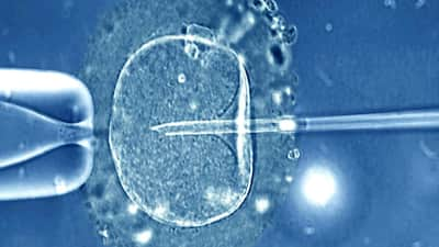 Do Frozen Eggs And Sperms Give Success Rates? Explains Dr Duru Shah