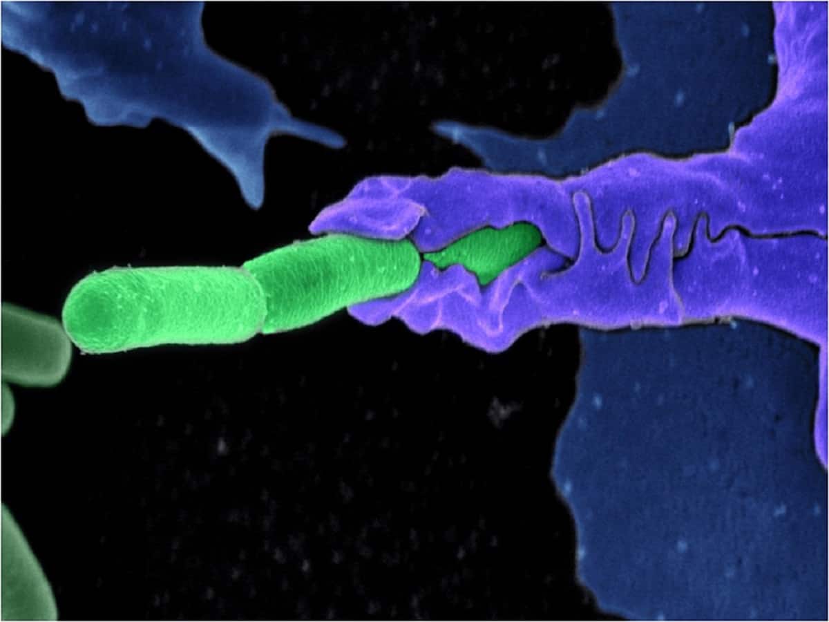 Autoimmune Disorders: Understanding Body's Misguided Response To Immune System - Vimarsana News