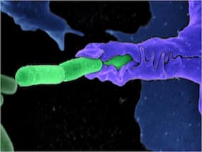Autoimmune Disorders: Understanding Body's Misguided Response To Immune System Autoimmune Disorders: Understanding Body's Misguided Response To Immune System