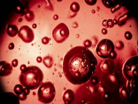 Vegetarian Superfoods For Anemia: 4 Iron Rich Foods That Can Raise Your Haemoglobin Levels