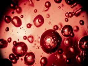 Vegetarian Superfoods For Anemia: 4 Iron Rich Foods That Can Raise Your Haemoglobin Levels