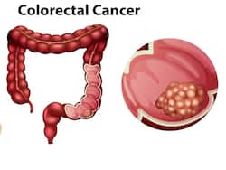 Problems And Solutions For Surgical Treatment Of Low Rectal Cancer
