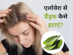 सिर में खुजली और डैंड्रफ की समस्या को जड़ से दूर करेगा एलोवेरा, इन 4 तरीकों से करें इस्तेमाल
