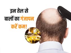 बरसात के पानी से गंजे हो सकते हैं आप! इन 5 आयुर्वेदिक तेल से तुरंत करें झड़ते बालों का इलाज