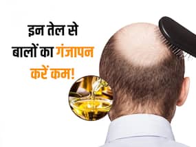बरसात के पानी से गंजे हो सकते हैं आप! इन 5 आयुर्वेदिक तेल से तुरंत करें झड़ते बालों का इलाज