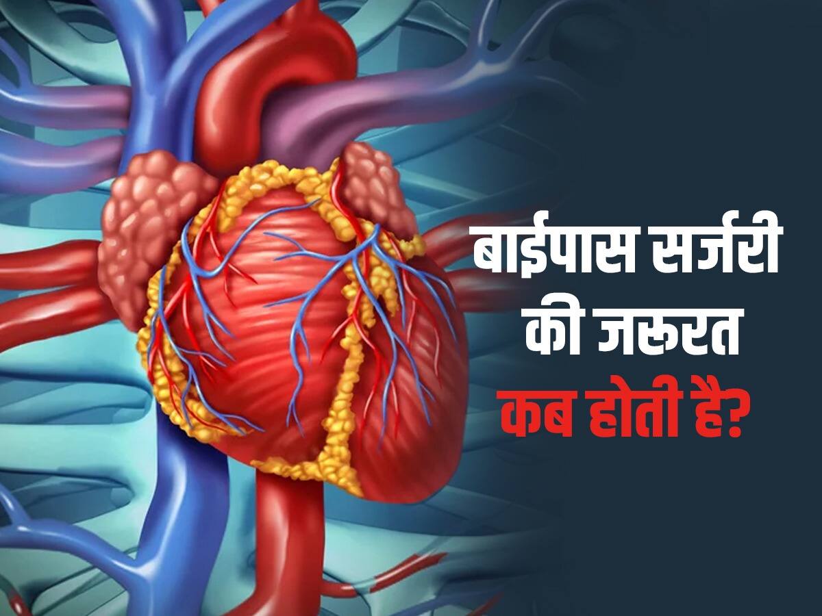 Bypass Surgery Kya Hoti Hai हार्ट पेशेंट को Bypass Surgery की जरूरत