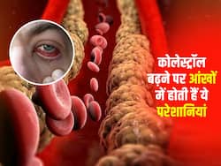 नसों में Bad Cholesterol चिपकने की वजह से आंखों में होने लगती है ये परेशानियां, तुरंत करें खानपान में बदलाव