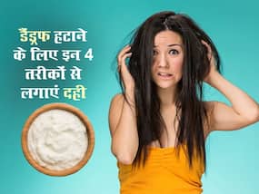 डैंड्रफ से छुटकारा पाने के लिए इन 4 तरीकों से करें दही का इस्तेमाल, हेयर फॉल भी होगा कंट्रोल