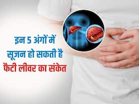 शरीर के इन 5 अंगों में सूजन हो सकती है फैटी लिवर का संकेत, भूलकर भी न करें इग्नोर शरीर के इन 5 अंगों में सूजन हो सकती है फैटी लिवर का संकेत, भूलकर भी न करें इग्नोर