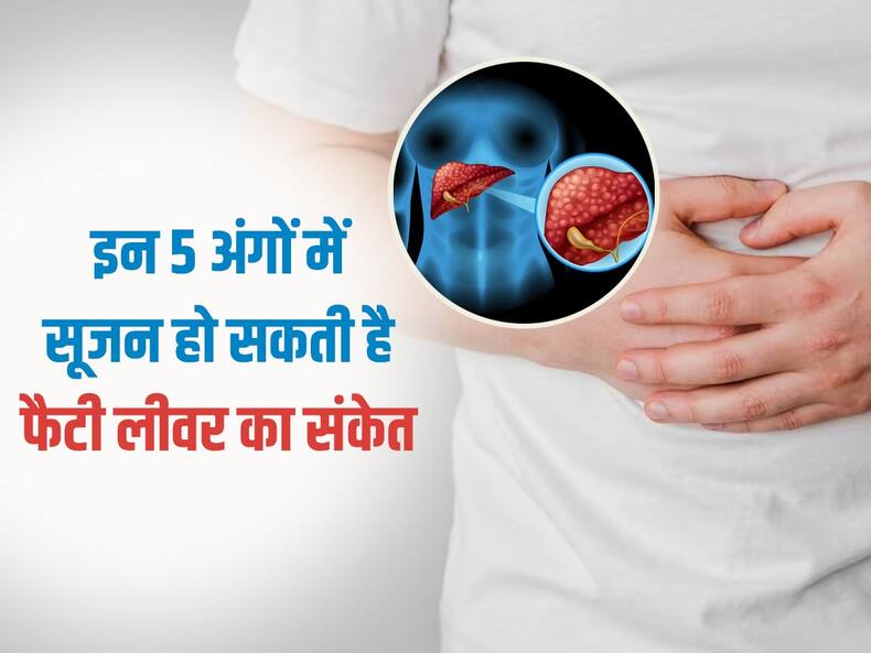 शरीर के इन 5 अंगों में सूजन हो सकती है फैटी लिवर का संकेत, भूलकर भी न करें इग्नोर