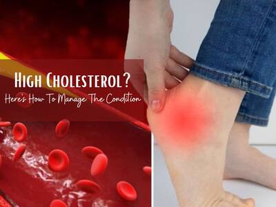 Bad Cholesterol Management Tips: What to Do When High Cholesterol Runs in Your Family?