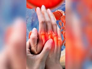 High Cholesterol Unusual Symptoms: 10 Signs Your Body Has Too Much Bad Cholesterol