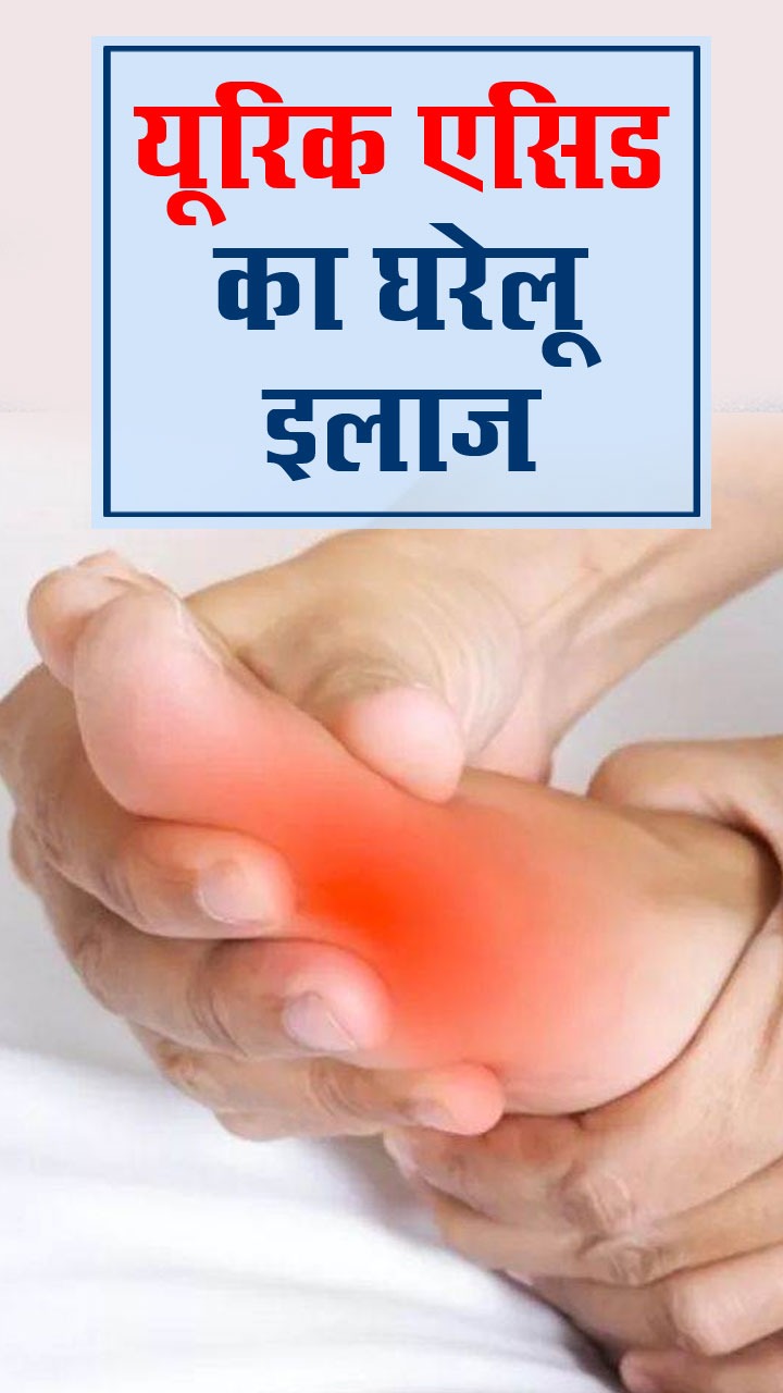 बिना दवा के यूरिक एसिड कम करने के 7 आसान उपाय