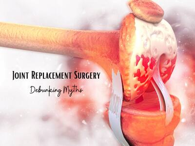 Joint Replacement Surgery: Understanding Top 5 Myths And Facts