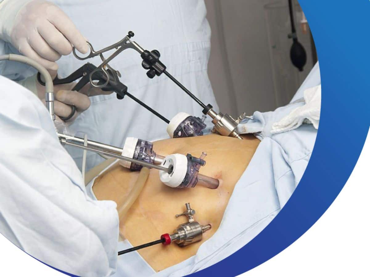 ST Indonesia Medical - LAPBAG Specimen Retrieval Pouch The Sejong LapBag  Specimen Retrieval Bag utilizes a flexible plastic bag to capture tissue  easily & safely during laparoscopic procedures. * Automatic pouch  automatically