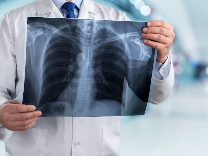 7 Most Common Lung Diseases And Their Warning Symptoms