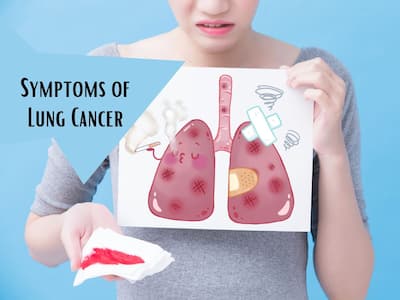 10 Surprising Rare Symptoms of Lung Cancer You Should Never Ignore