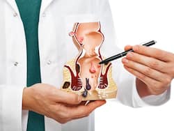 खूनी बवासीर की परेशानी को दूर कर सकता है फ्री में मिलने वाला ये एक चीज, इस तरह करें इस्तेमाल