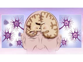 Dementia Care: Here's Why Person-Centred Care Is Important? Dementia Care: Here's Why Person-Centred Care Is Important?