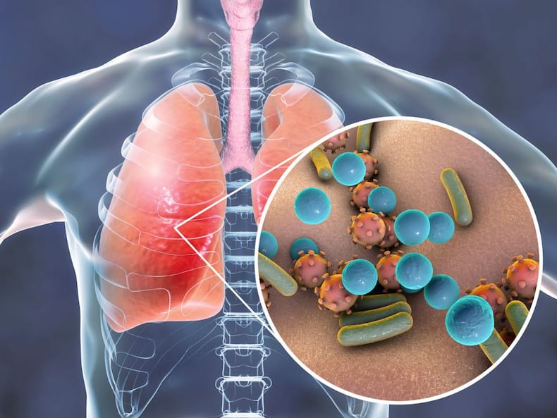 7 Most Common Lung Diseases And Their Warning Symptoms
