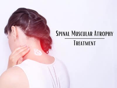 Spinal Muscular Atrophy Treatment And Management: Cost, Guidelines And Other Things To Know