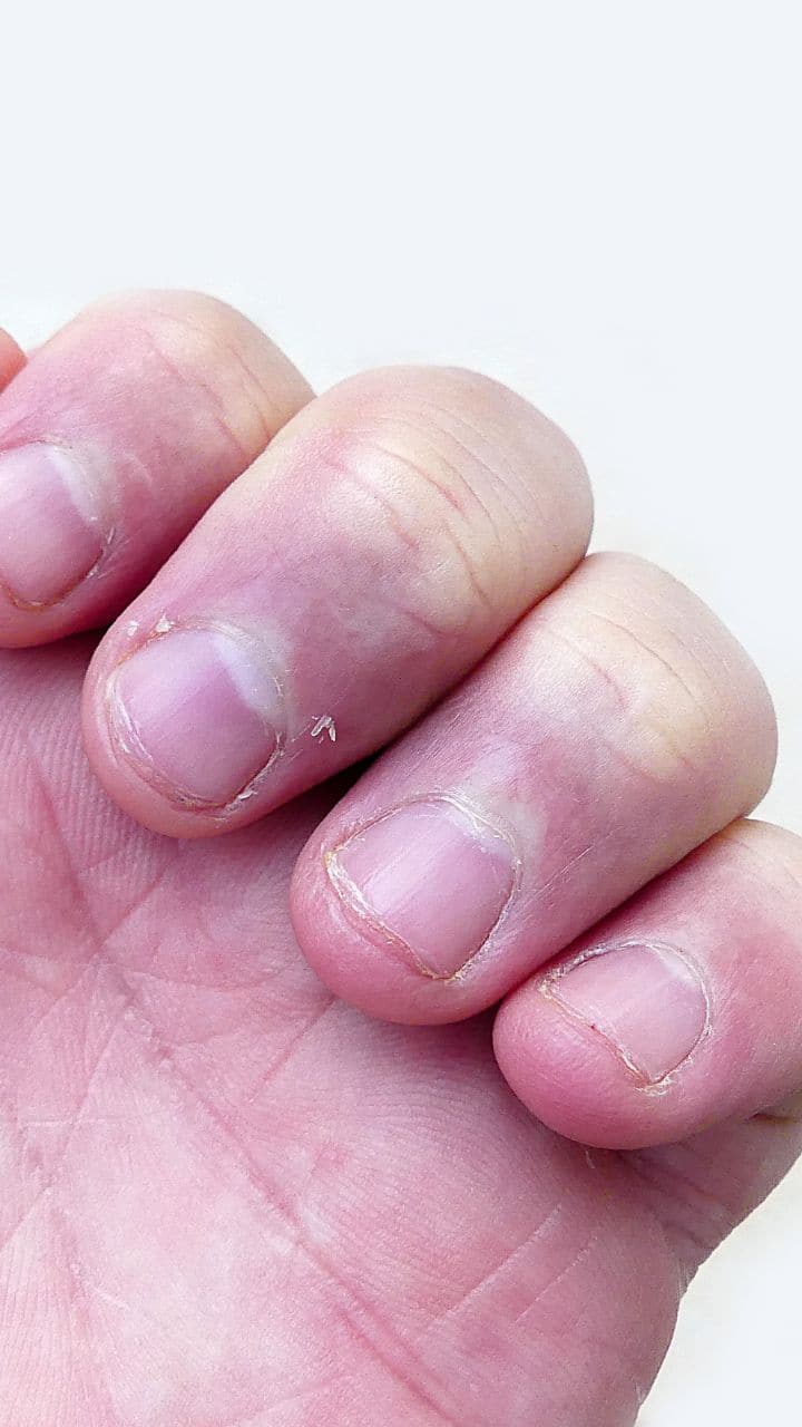 How To Tell If Your Nails Are Actually Healthy Or Not