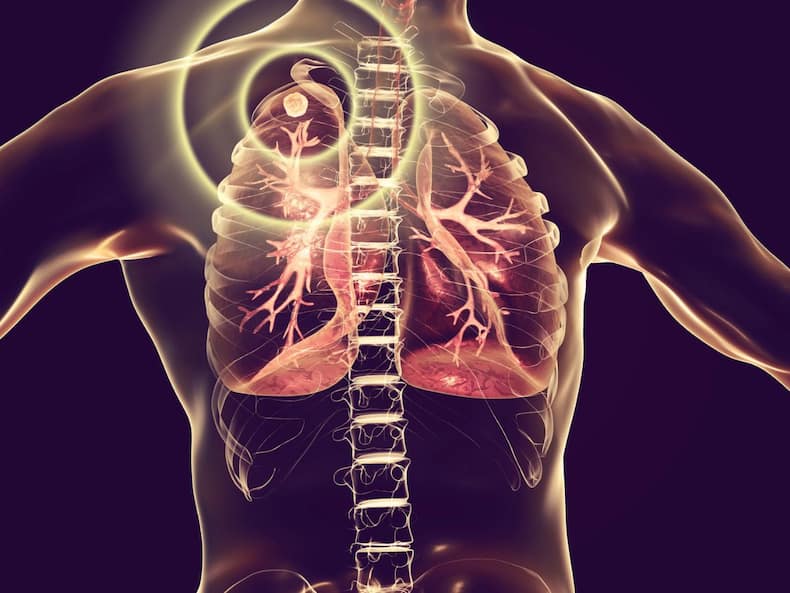 7 Most Common Lung Diseases And Their Warning Symptoms