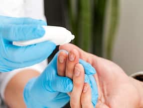 What Causes The Skin Around Your Nails To Peel?