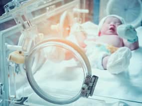Screening Methods For Spinal Muscular Atrophy (SMA): Newborn Screening Vs Prenatal Screening