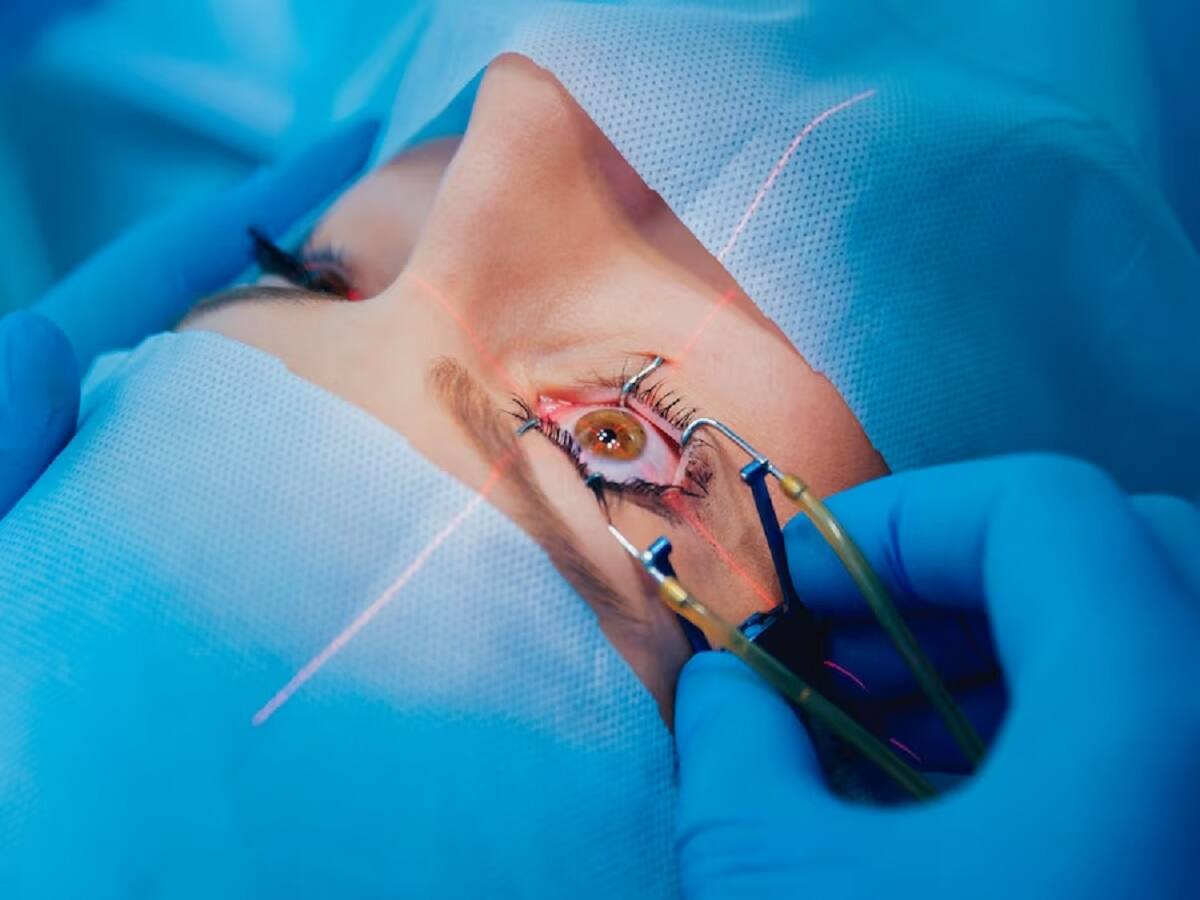 How To Decide If Laser Vision Correction Is The Right Option For You - Vimarsana News