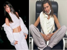 Supermodel Bella Hadid Is Battling With Lyme Disease: Learn More About This Tick-Borne Disease