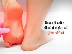 जोड़ों में जमा यूरिक एसिड का खात्मा करेंगी किचन में रखी ये चीजें,  इस तरह करें इस्तेमाल