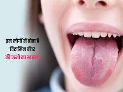 इन लोगों में होता है विटामिन बी12 की कमी का खतरा अधिक, एक्सपर्ट से जानिए इसके संकेत