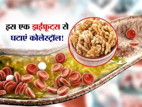 सिर्फ इस 1 ड्राईफ्रूट्स से नसों में चिपके कोलेस्ट्रॉल को कर सकते हैं कम, इस तरह करें सेवन