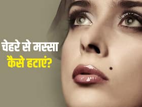 चेहरे पर मस्सा आपकी खूबसूरती को कर सकता है खराब, इन 5 नुस्खों से हटाएं ये दाग