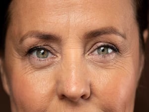 Wrinkles: Causes, Treatment & Prevention for Aging Skin