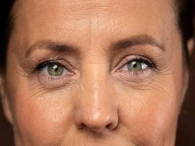 Age Alone Is Not To Blame For Wrinkles: Here Are Other Possible Causes Of Wrinkles
