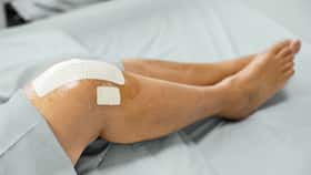 Can Knee Arthritis Increase Your Risk Of Getting A Hip Fracture? Can Knee Arthritis Increase Your Risk Of Getting A Hip Fracture?
