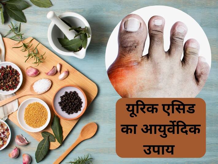 Uric Acid ka Ayurvedic Upchar शरीर से यूरिक एसिड को निचोड़कर बाहर