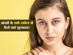 आंखों के डार्क सर्कल को मेकअप से छिपाएं नहीं! इन 6 उपायों करें काले घेरों का इलाज