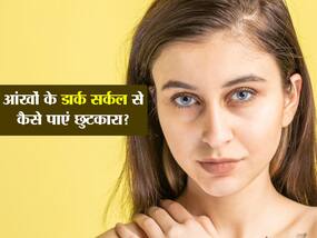 आंखों के डार्क सर्कल को मेकअप से छिपाएं नहीं! इन 6 उपायों करें काले घेरों का इलाज