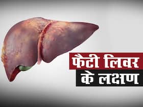 फैटी लिवर होने पर सूजने लगते हैं शरीर के ये 5 अंग, जानिए फैटी लिवर के 5 बड़े लक्षण