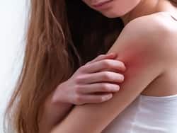 Do You Have Dry Skin Problem? Here's A List Of Vitamins and Supplements To Help